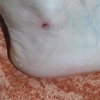 Ayakkabı Dünyası İle Yaşadığım Sorun