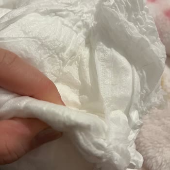 Sleepy Bebek Bezi Sıkıntısı!