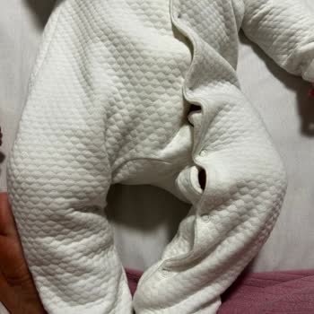 Hello Baby Ebebek Tulum Bedenlerindeki Hata