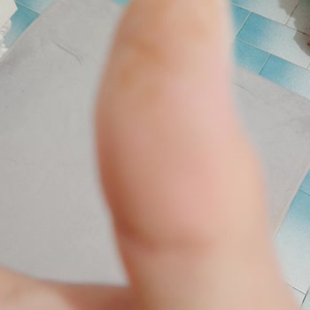 Bingo Hassas Ellere Zarar Veren Deterjan!