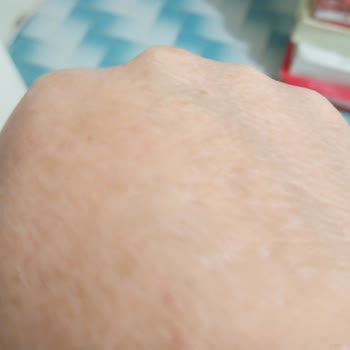 Bingo Hassas Ellere Zarar Veren Deterjan!