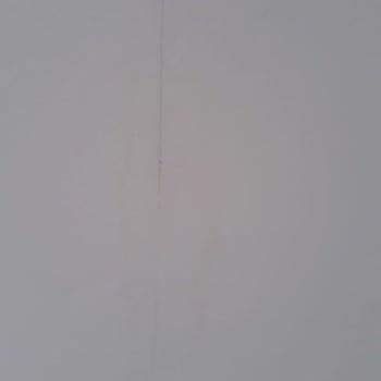 Anadolu Sigorta Hasar Ve Ödeme