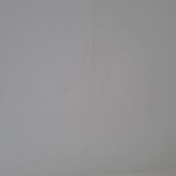 Anadolu Sigorta Hasar Ve Ödeme