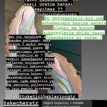 Skechers Ayakkabı Üretim Hatası!