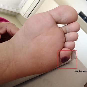 Slazenger Garantisiz Ayakkabı Satıyor Ve Outdoor Giymek İşkence