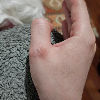 Dyson V8 Gave Me A Wound, I Can't Hold It In My Hands