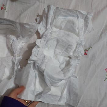Molfix Bebek Bezinin İçi Dağınık Geldi