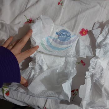 Molfix Bebek Bezinin İçi Dağınık Geldi