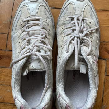 7 Ayda Yırtılan Sketchers Ayakkabı Sorunu
