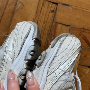 7 Ayda Yırtılan Sketchers Ayakkabı Sorunu