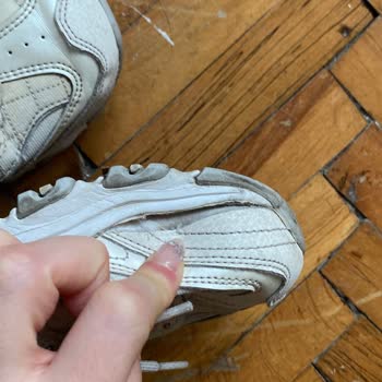 7 Ayda Yırtılan Sketchers Ayakkabı Sorunu