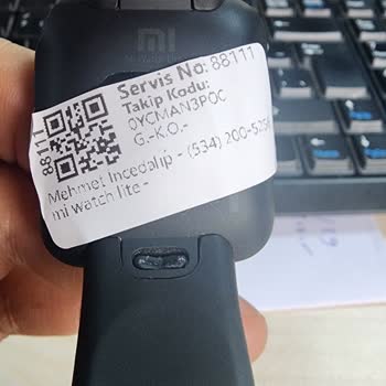 Mobilfix Ve Yapılamayan Xiaomi Akıllı Saat Tamiri