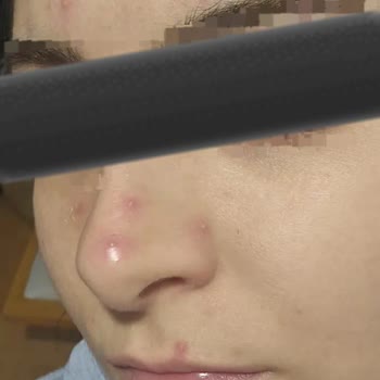 Neutrogena Hydro Boost Serum Yüzümü Mahvetti!