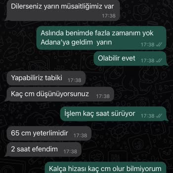 Burak Karcı Hair Designer Saçlarım Kökünden Koptu Mahkemelik Olduk