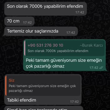 Burak Karcı Hair Designer Saçlarım Kökünden Koptu Mahkemelik Olduk