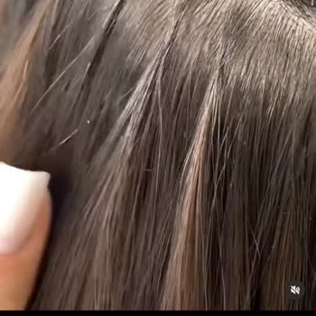 Burak Karcı Hair Designer Saçlarım Kökünden Koptu Mahkemelik Olduk