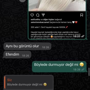 Burak Karcı Hair Designer Saçlarım Kökünden Koptu Mahkemelik Olduk
