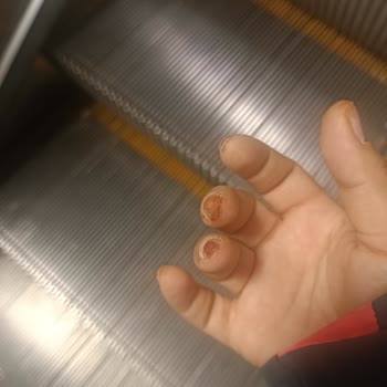 Aymira Koçaklı Yaşam Merkezi Parmaklarımı Yaktı