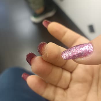 Aymira Koçaklı Yaşam Merkezi Parmaklarımı Yaktı