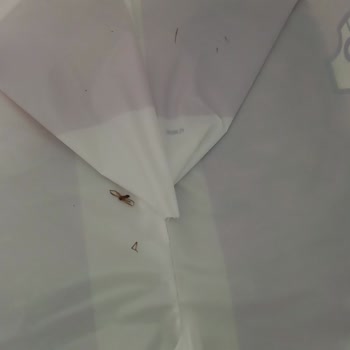 Canbebe Bebek Bezinde Örümcek Ölüsü Çıktı