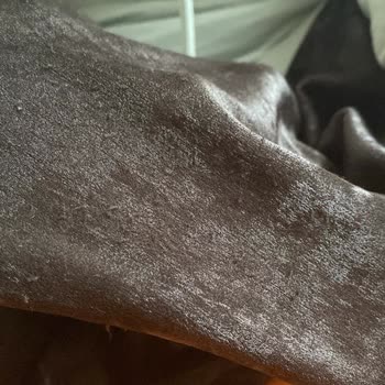 Manuka Abiye Tüylenme Sorunu