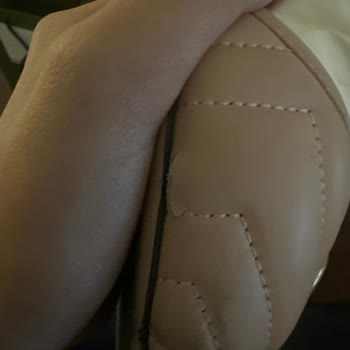 Gucci Den Aldığın Terlik İki Kez Giyildi Ve Yırtıldı