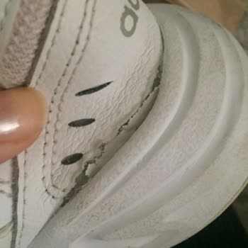 Adidas'tan Aldığım Ayakkabı Patladı