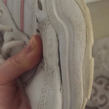 Adidas'tan Aldığım Ayakkabı Patladı