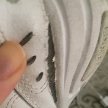 Adidas'tan Aldığım Ayakkabı Patladı