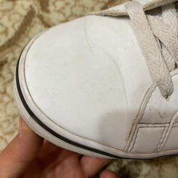 Adidas Ayakkabı Koku, Çatlak, Lekelenmesi.