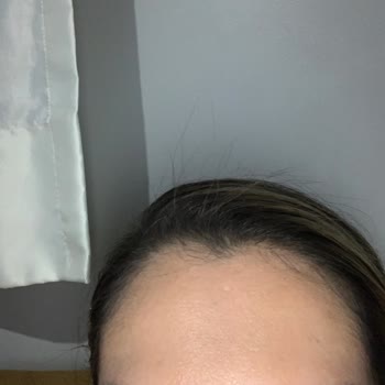 Elif Gülyol Kalıcı Makyaj Kaş İle İlgisi Yok