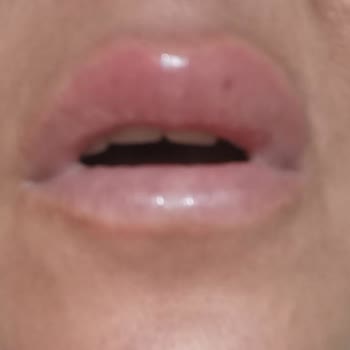 Sephoranın Alerji Yapan Ürün İadesi İçin Doktor Raporu İstemesi