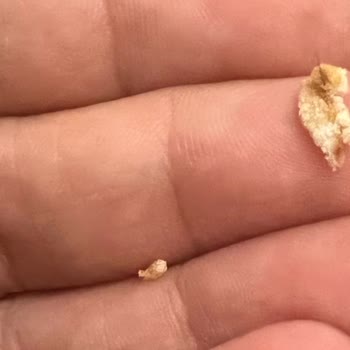 Ülker Dankek Rulo Üründe Kıl