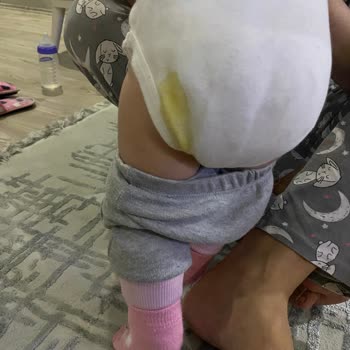 Prima Pişik Ve Bez Dışına Kaçırma