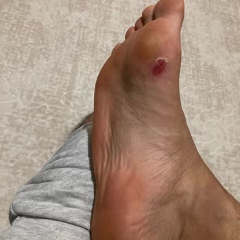 Boyner - Ayağımı Mahveden Krampon