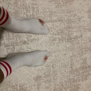 Boyner - Ayağımı Mahveden Krampon