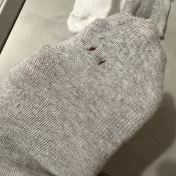 Beko Çamaşır Makinesi Çamaşırları Deliyor