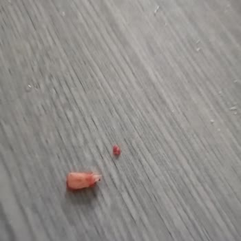 Beşler Sucuk Sucuktan Çıkan Sert Cisim Dişimi Zarar Verdi