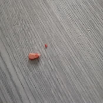 Beşler Sucuk Sucuktan Çıkan Sert Cisim Dişimi Zarar Verdi