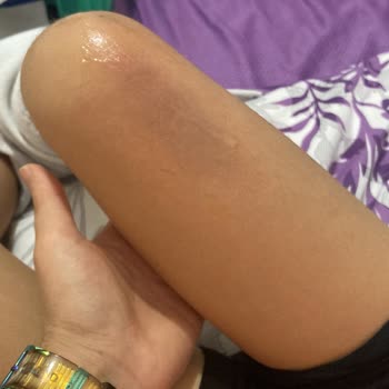 Betüş Bebe & Genç Mobilya Mobilya Kırılması Şikayeti