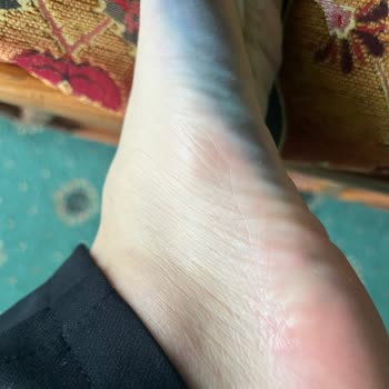 Skechers Boya Akıtıyor Ve Çıkmıyor