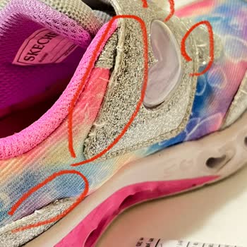 Skechers Bağdat Caddesi 2 Aylık Ayakkabının Hali