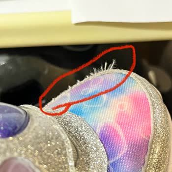 Skechers Bağdat Caddesi 2 Aylık Ayakkabının Hali