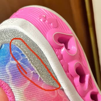 Skechers Bağdat Caddesi 2 Aylık Ayakkabının Hali