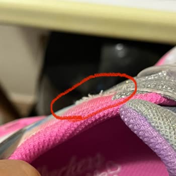 Skechers Bağdat Caddesi 2 Aylık Ayakkabının Hali