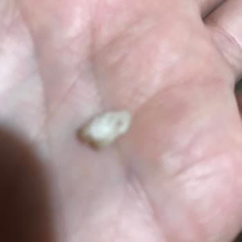 Edemen Et ve Et Ürünleri (Bursa) Kıymadan Kemik Çıktı