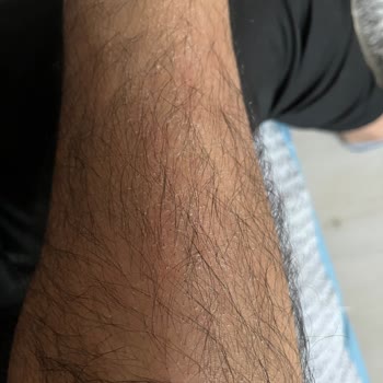 Genveon İlaç Firması Bozuk İlaç Satıyor Galiba