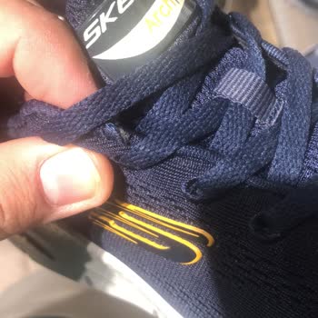 Skechers Ayakkabının Kalitesizliği