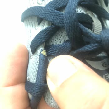 Skechers Ayakkabının Kalitesizliği