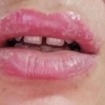 Yıldızca Beauty Kötü İşlem Canım Yandı